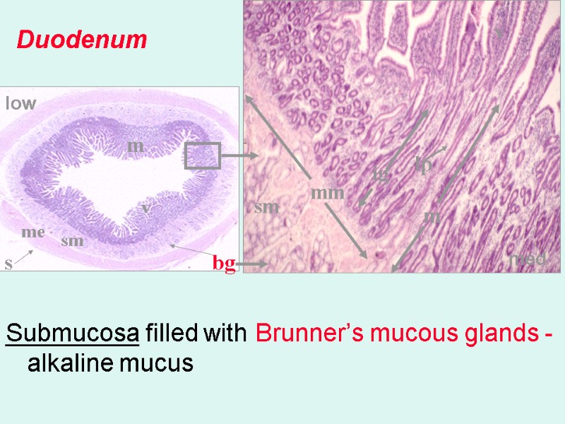 Submucosa filled with Brunner’s mucous glands - alkaline mucus   Duodenum v v